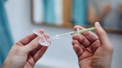 The Ultimate Guide to Dental Aligners: What They Are, How They Work, and Why They're Worth the Investment