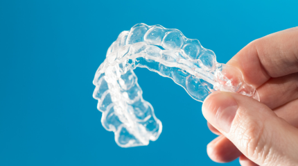 Aligners: A Comprehensive Guide to Straightening Your Teeth