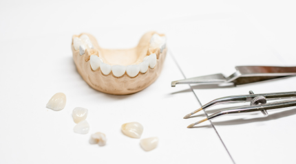 The Complete Guide to Dental Veneers: A Lifehack for Perfect Teeth