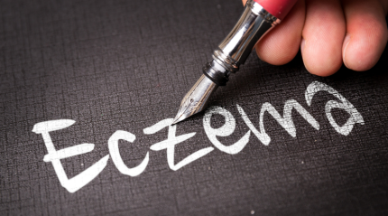 Eczema Treatment: Natural Remedies and Medical Solutions for Soothing Itchy Skin