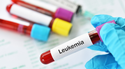 Leukemia Treatment: A Comprehensive Guide