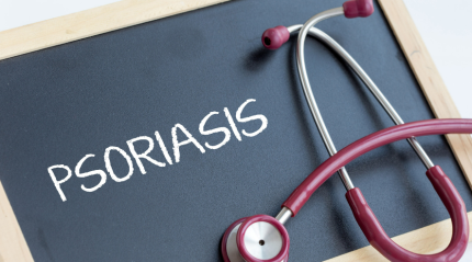 Unleashing the Power of Nature in Plaque Psoriasis Treatment