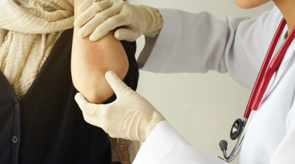 Understanding Psoriasis and Its Various Treatment Options